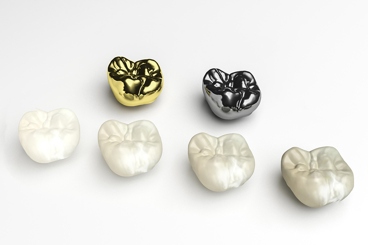 dental crowns in midnapore